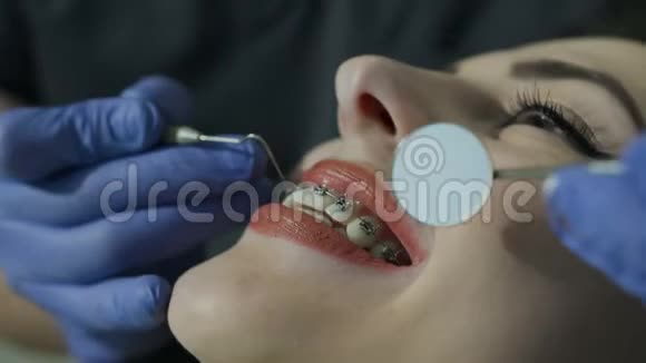 健康的牙齿特写镜头在牙医检查牙齿时帕斯蒂尼特带着健康的牙齿愉快地微笑视频的预览图