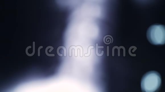 颈部脊柱核磁共振扫描或X射线摄片视频的预览图