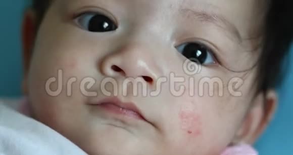 皮肤过敏的健康护理婴儿视频的预览图