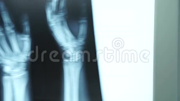 在医疗诊所工作的人看起来像手臂X光视频的预览图