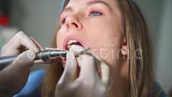 特写镜头女人的嘴给谁清理口腔视频的预览图