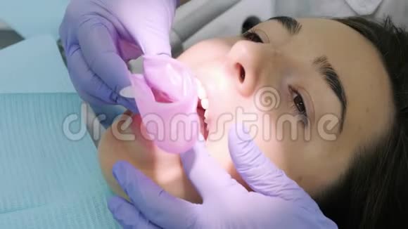 牙医把扩口器放在牙科办公室里给一个漂亮的女孩视频的预览图