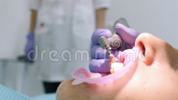 一位牙医使用设备打磨女性牙齿的特写镜头视频的预览图