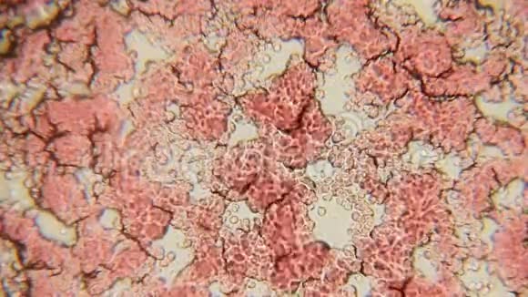 血细胞通道100x在卤素的作用下血小板在100倍放大时形成一个小通道视频的预览图