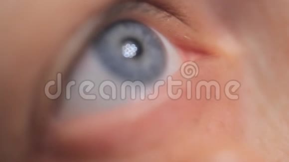 一个年轻的女人滴着药滴在她的眼睛里特写视频的预览图