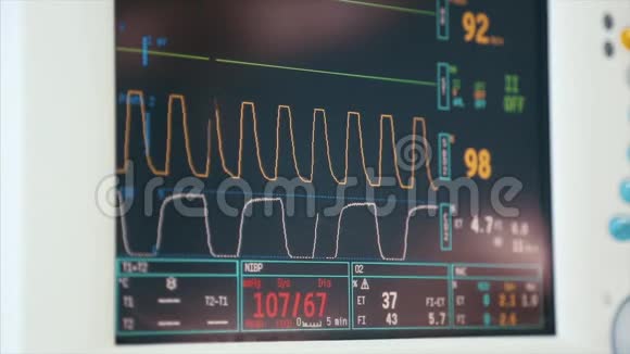 数字心脏监测器读出接近线图形和数字显示的病人被测量视频的预览图