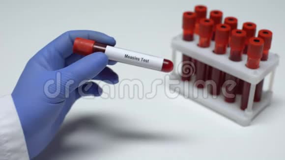麻疹检查医生在试管中显示血样实验室研究健康检查视频的预览图