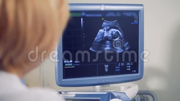 有胎儿图像的超声波监视器医学超声波扫描视频的预览图