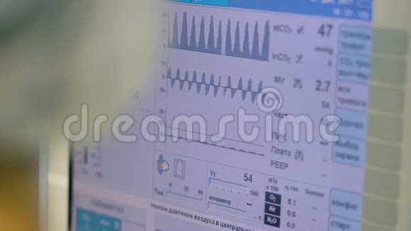 一个屏幕显示病人数据从医疗呼吸机视频的预览图