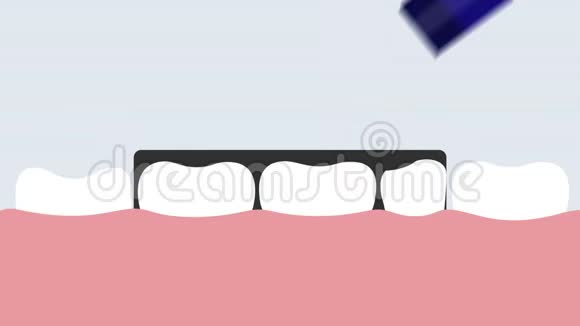 牙科数字X光处理2d动画视频的预览图