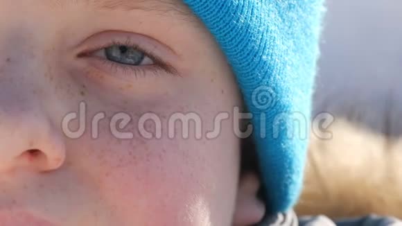 一个男孩戴着蓝帽子脸上长着蓝眼睛和雀斑看着镜头近距离观看视频的预览图