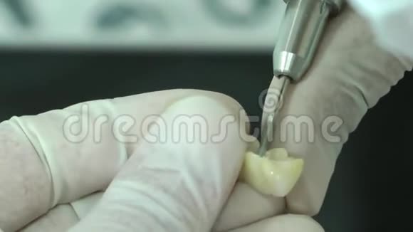 介绍锆瓷牙造型的牙科实验室视频的预览图