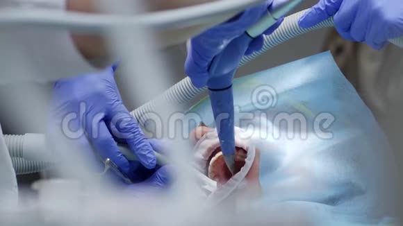 医疗程序和保健用面巾纸无菌者口腔洁牙视频的预览图