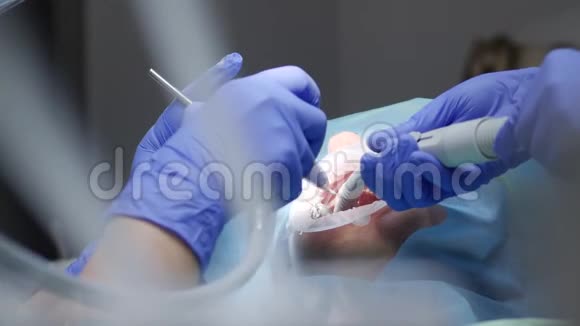 医学研究戴橡胶无菌手套的医生借助特殊的牙科器械清洗病人的牙齿视频的预览图
