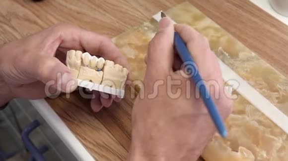 在木制工作台上制作种植牙人工牙齿上涂陶瓷釉的人手臂视频的预览图