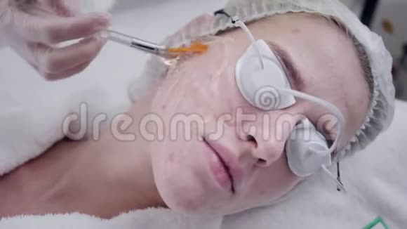 医生给病人涂上一种特殊的凝胶用专业设备抗痘光疗美丽的女人视频的预览图