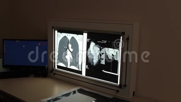 内科诊所内器官X线检查视频的预览图