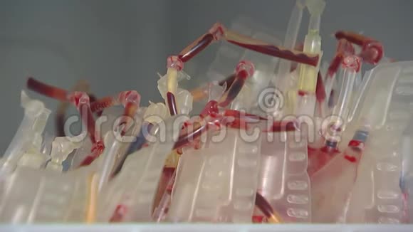 冷冻献血者血液含人血浆的医疗包视频的预览图