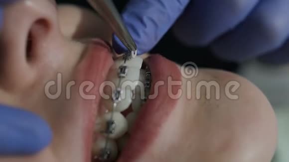 健康的牙齿在牙科检查中一位牙医的客户视频的预览图