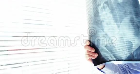 男性医生检查x光视频的预览图