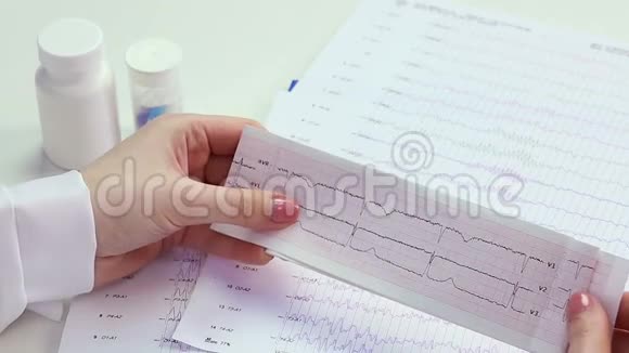 心脏病专家研究病人的心脏活动检查心电图心电图心电图视频的预览图