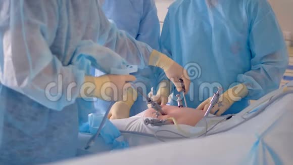 手术期间使用无菌医疗设备的外科医生组4K视频的预览图