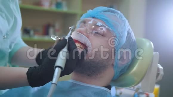 医生和病人在牙科办公室用扩唇器用刷子抛光视频的预览图
