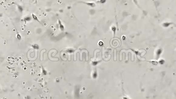 实验室显微镜下观察人类精子视频的预览图