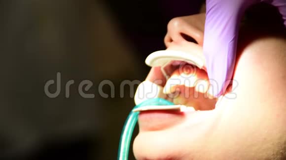 牙医用牙镜检查病人咬合情况及固定器具的设置过程视频的预览图