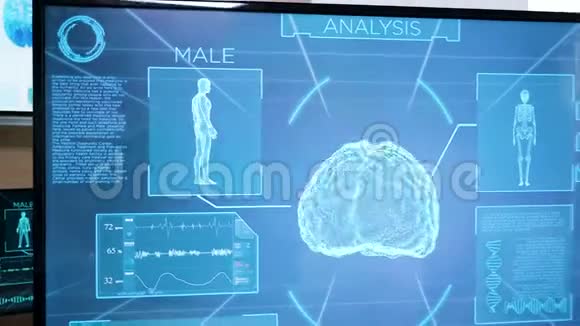 神经学博士为病人做脑部扫描准备视频的预览图