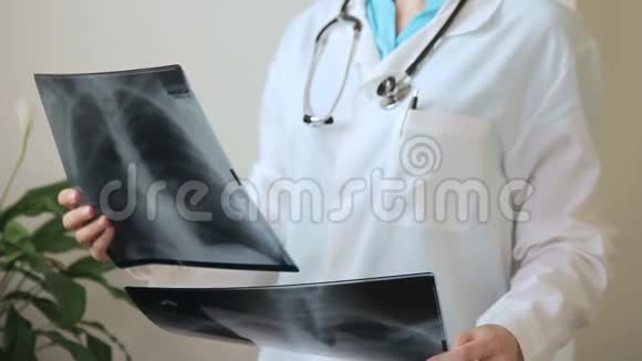 医生用听诊器比较了两张X光片视频的预览图