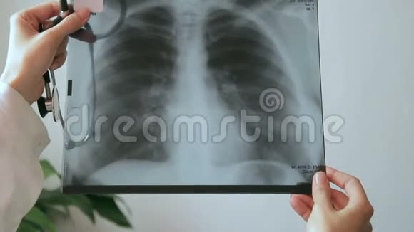 医生手里拿着一张人体胸部x光照片视频的预览图