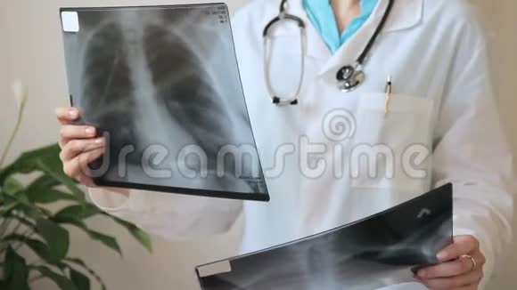 医生在诊所比较两张人胸部X线照片视频的预览图