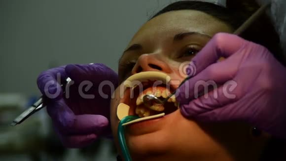 牙医把牙托放在病人的牙齿上用牙镜检查而不是用激光固定视频的预览图