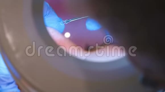 美容师的面部清洁用针头和放大镜挤压鼻子上的粉刺视频的预览图