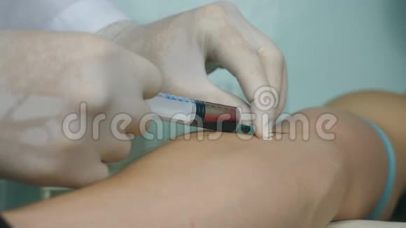 做个血样化验医生把注射器注入病人的静脉医疗器械服用视频的预览图