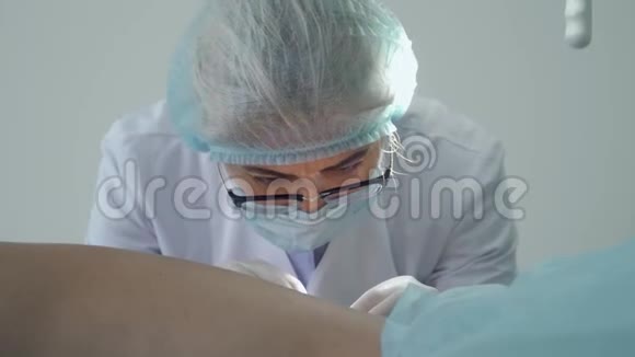 皮肤科医生在病人皮肤上燃烧痣视频的预览图