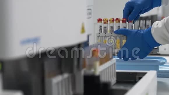 实验室技术人员在自动化医疗设备中准备尿液样本视频的预览图