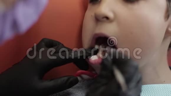 牙科医生的小男孩张开嘴坐在椅子上视频的预览图