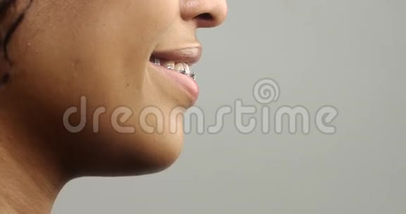 女人张开嘴像牙套上的喊叫牙科恐惧概念视频的预览图
