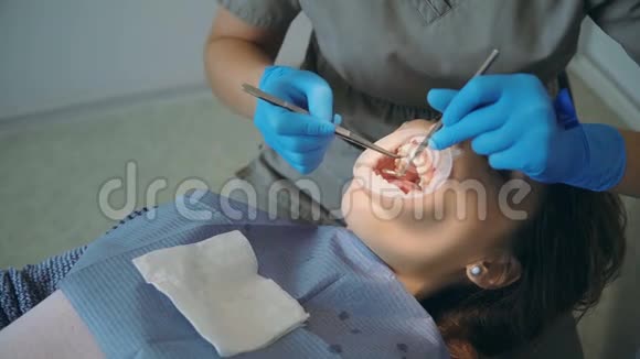 年轻女子躺在牙科椅上牙医清洁和抛光她的牙齿医生和护士一起服用视光剂视频的预览图