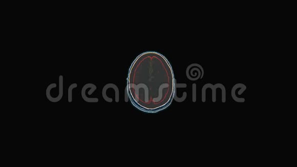 头颅MRI扫描图像视频的预览图