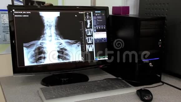 X线解剖学视频的预览图