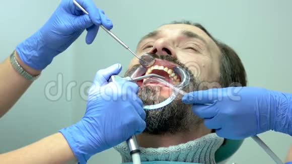 病人和牙医的手视频的预览图