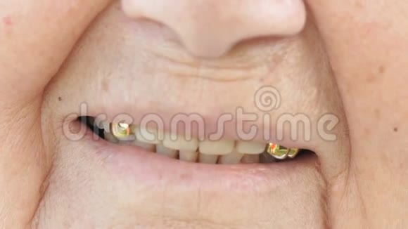 假牙的成熟老女人微笑的嘴视频的预览图