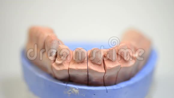 牙科技师为种植牙提供3D打印模具视频的预览图