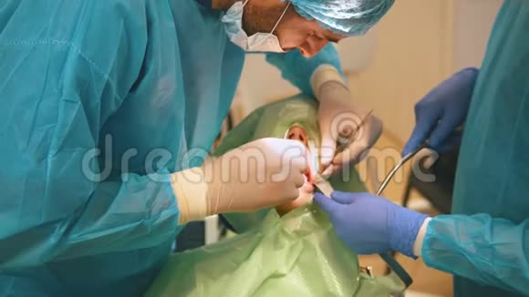 牙科医生用外科钳子去除口腔科的蛀牙视频的预览图