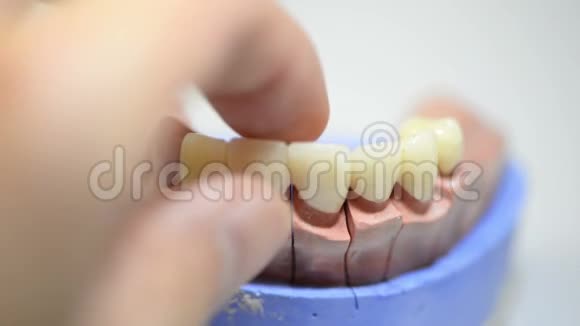 牙科技师在实验室为种植牙制作3D打印模具视频的预览图