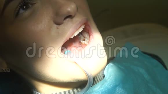 可爱的女孩从牙医那里治疗牙齿视频的预览图