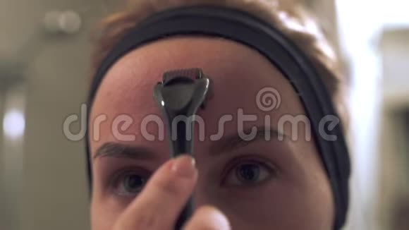 将年轻女性用真皮滚轮进行微针治疗面部视频的预览图